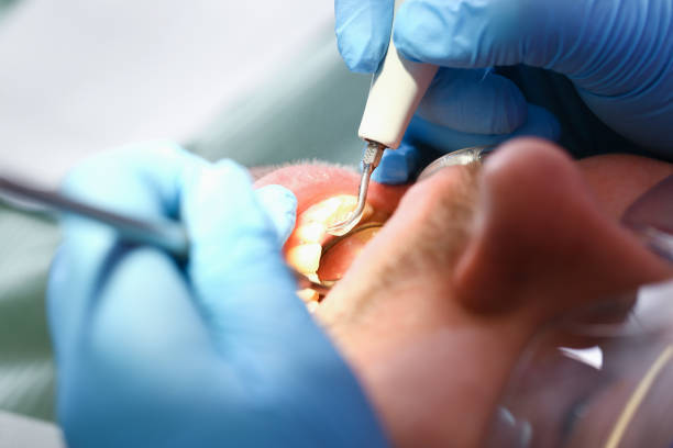 Best Emergency Denture Repair in Essex, MD